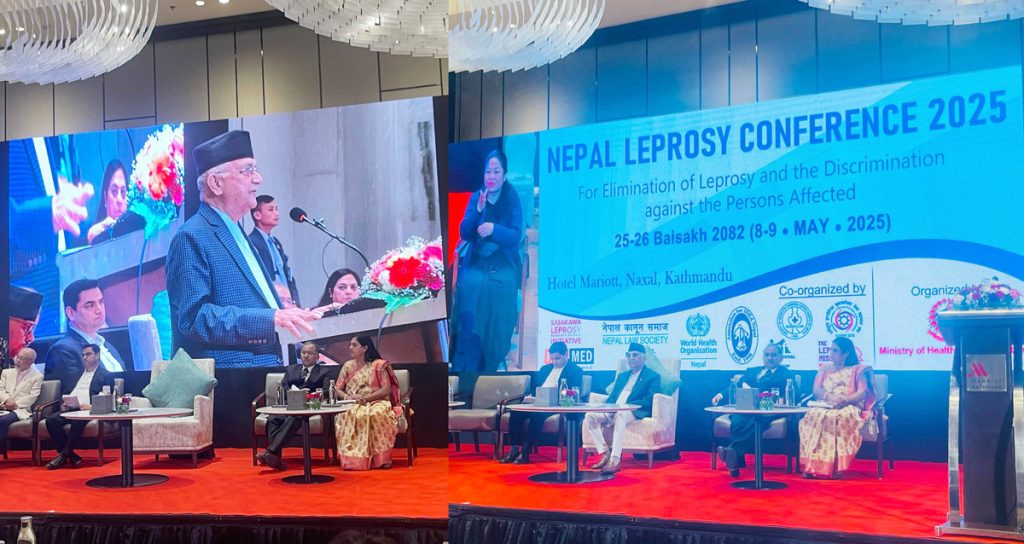 कुष्ठरोगका सबैभन्दा बढी विरामी मधेश प्रदेशमा